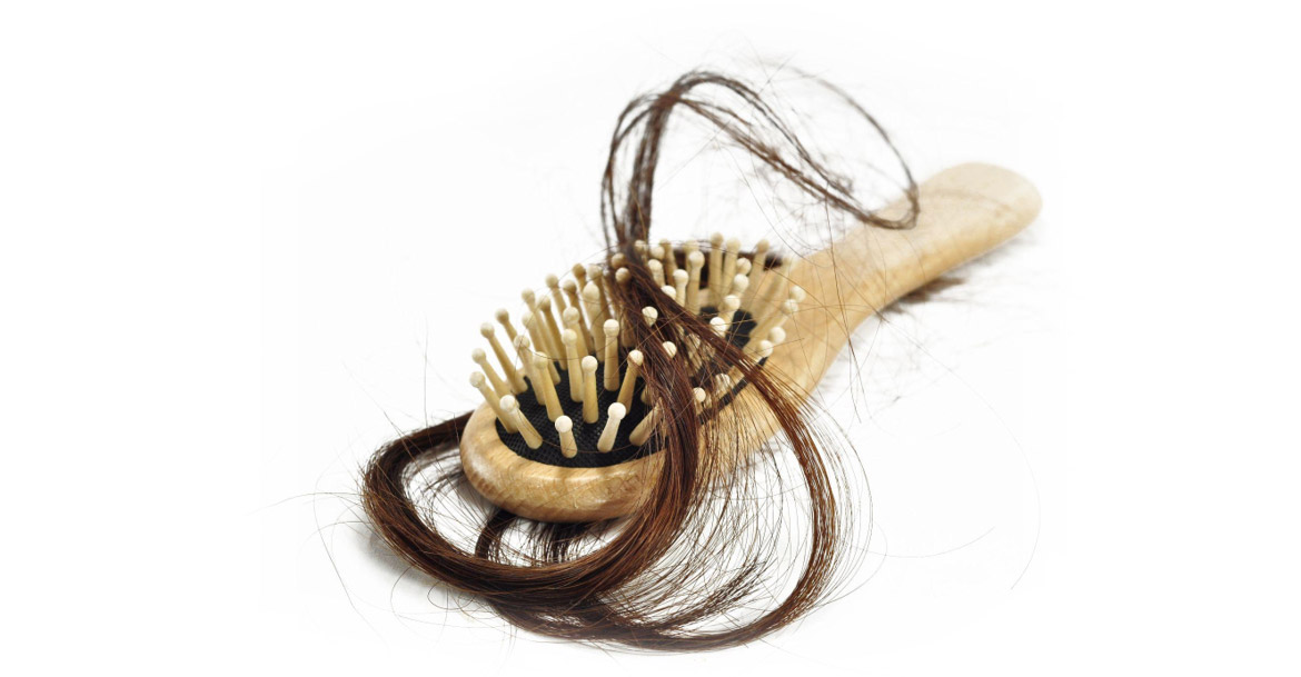 Szczotka z kosmykiem włosów, obrazująca problem wypadania włosów